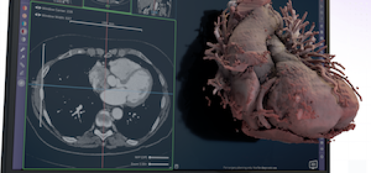 3-D software, medical image processing