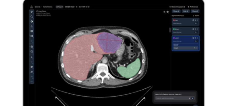 Raidium Debuts New AI-Native PACS Viewer