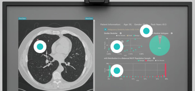 RevealDx Receives MDR Certification for RevealAI-Lung