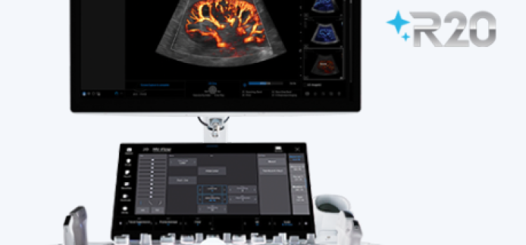 Samsung to Introduce New Ultrasound System at RSNA 2025