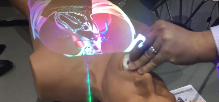 Ultrasound Transesophageal echo (TEE) | Imaging Technology News