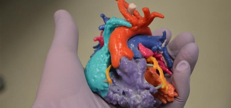 The Future of 3-D Printing in Medicine